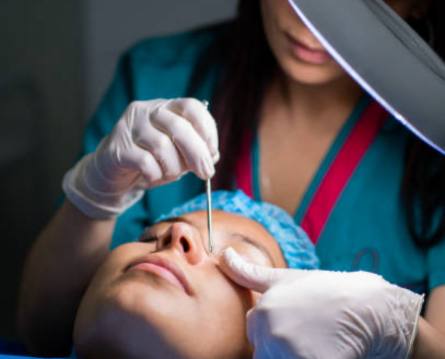 تجمیل الأنف