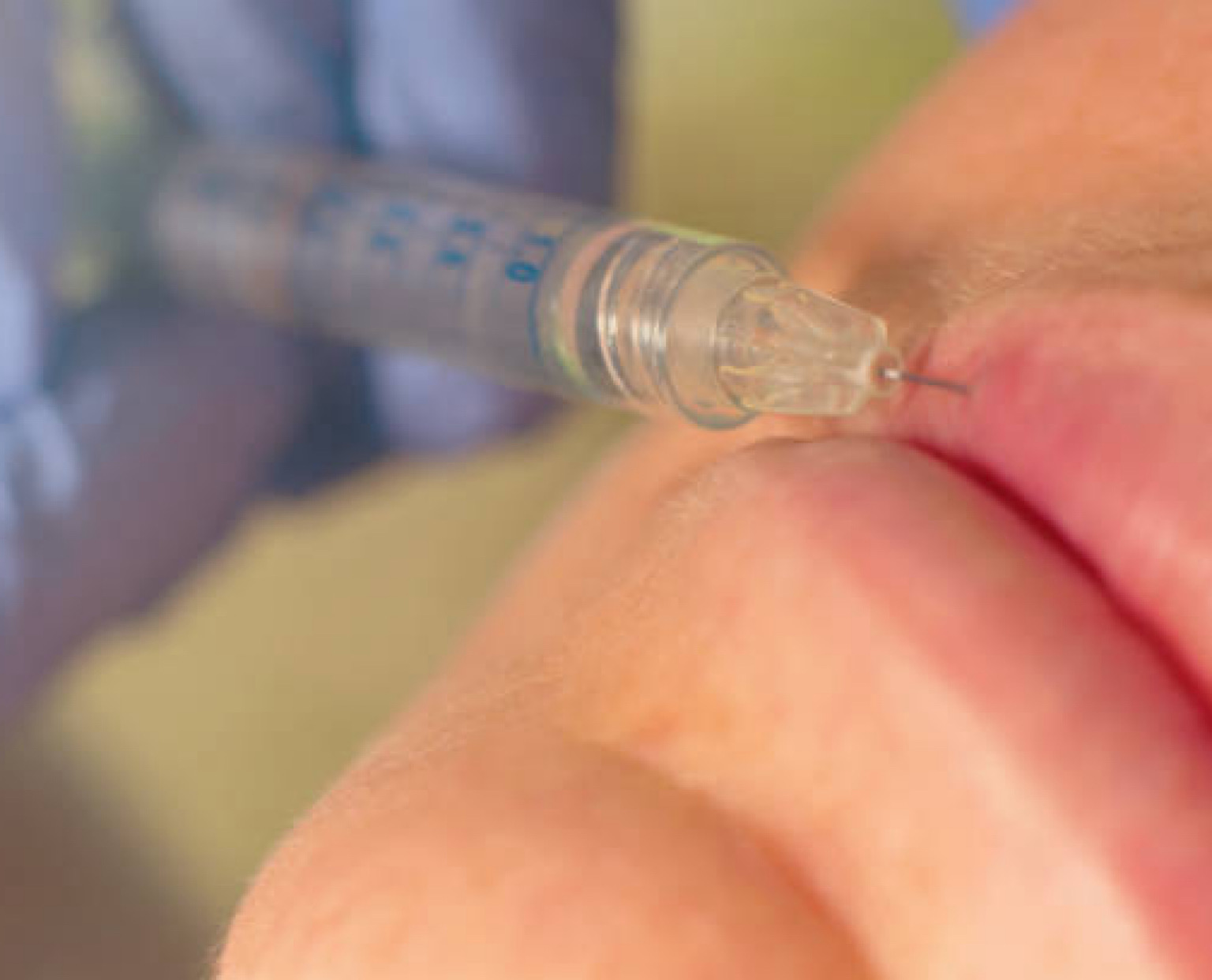 مترجمة طبية في شيراز تنسيق العلاج في شيراز حجز موعد طبي في شيراز